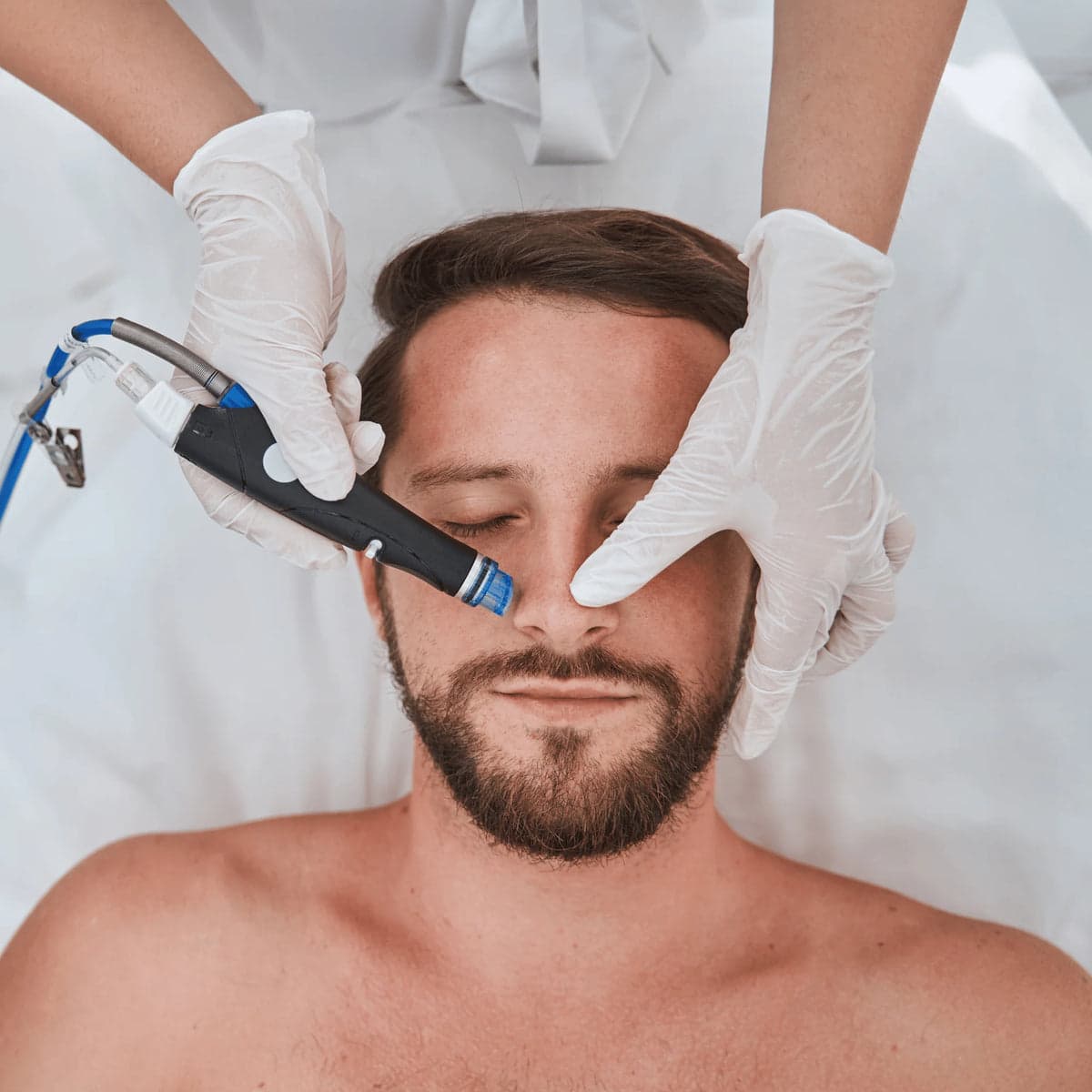 Hydrodermabrasion