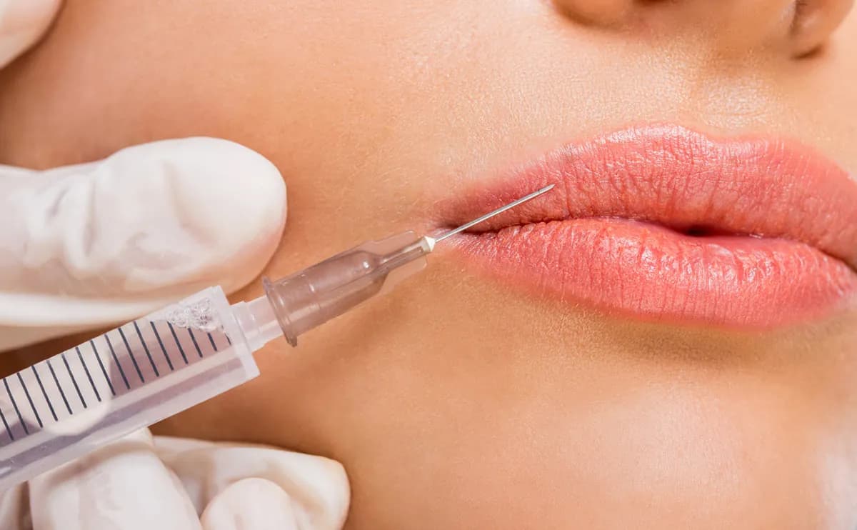 Juvederm