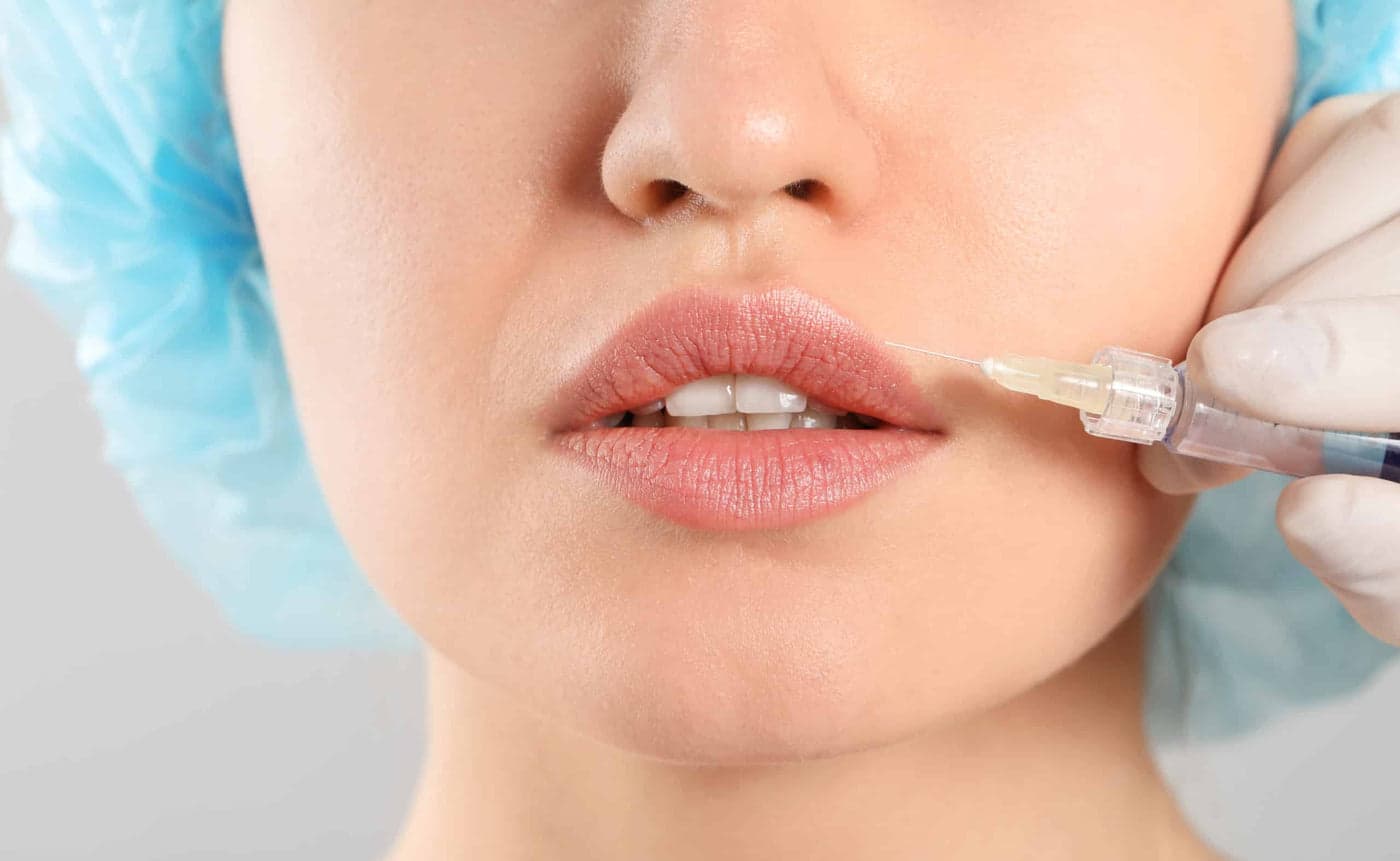 Juvederm