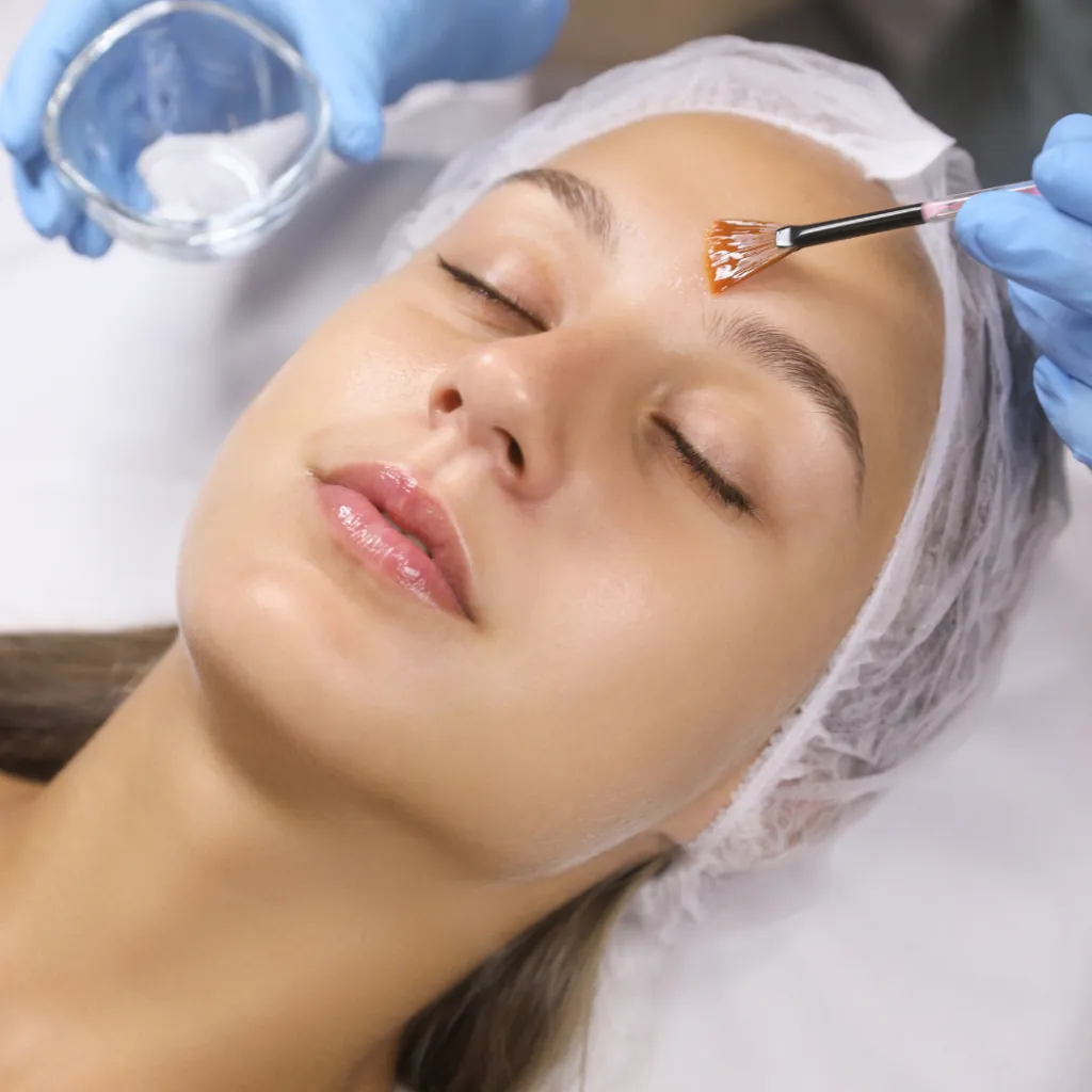 Micro-peels